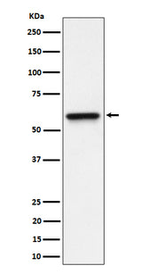 Anti-RGS6 Rabbit Monoclonal Antibody Boster Bio