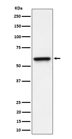 Anti-RGS6 Rabbit Monoclonal Antibody Boster Bio