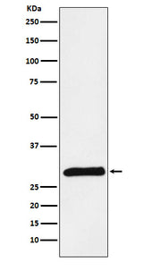 Anti-PRSS2 Rabbit Monoclonal Antibody Boster Bio