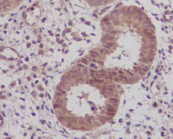 Anti-IKB beta Rabbit Monoclonal Antibody Boster Bio