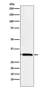 Anti-EB3 Rabbit Monoclonal Antibody Boster Bio