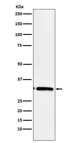 Anti-EB3 Rabbit Monoclonal Antibody Boster Bio