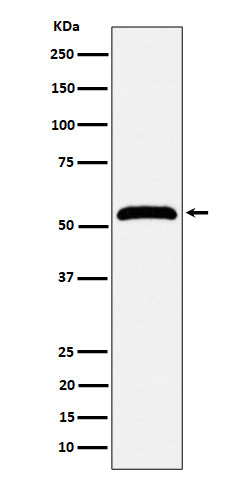 Anti-MPP1 Rabbit Monoclonal Antibody Boster Bio