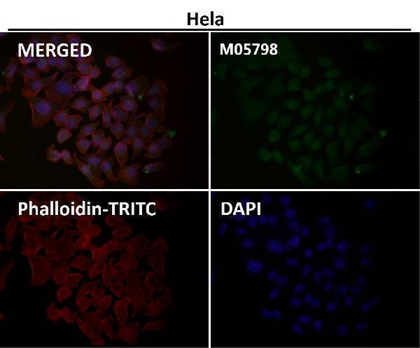 Anti-Cdc23/APC8 Rabbit Monoclonal Antibody Boster Bio