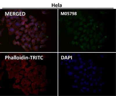 Anti-Cdc23/APC8 Rabbit Monoclonal Antibody Boster Bio