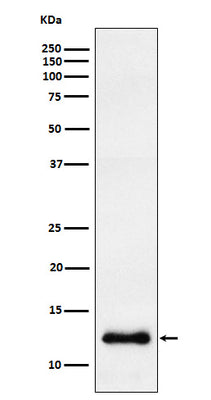 Anti-CCL23 Rabbit Monoclonal Antibody Boster Bio