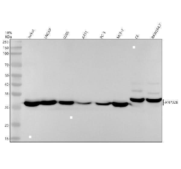 Anti-PHAPI2 / APRIL Rabbit Monoclonal Antibody Boster Bio