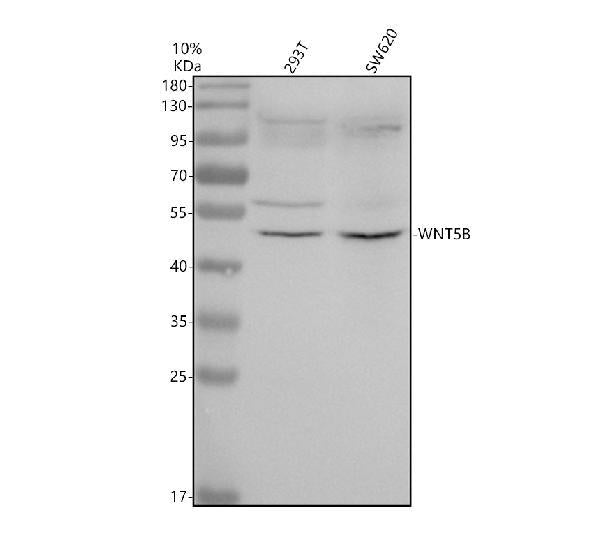 Anti-Wnt5b Rabbit Monoclonal Antibody Boster Bio