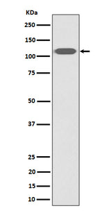 Anti-ZHX2 Rabbit Monoclonal Antibody Boster Bio