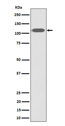 Anti-ZHX2 Rabbit Monoclonal Antibody Boster Bio