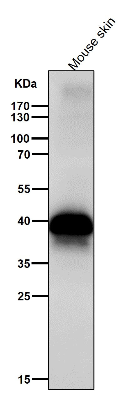 Anti-DLX3 Rabbit Monoclonal Antibody Boster Bio