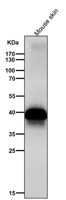 Anti-DLX3 Rabbit Monoclonal Antibody Boster Bio