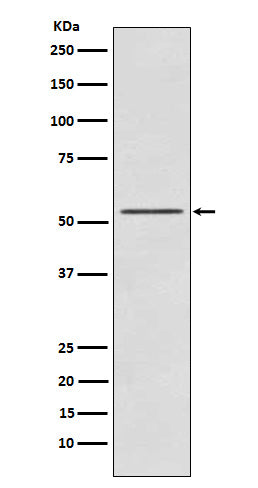 Anti-P70 S6 Kinase beta Rabbit Monoclonal Antibody Boster Bio