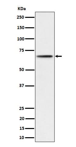 Anti-Phospho-P70 S6 Kinase beta (S371) Rabbit Monoclonal Antibody Boster Bio