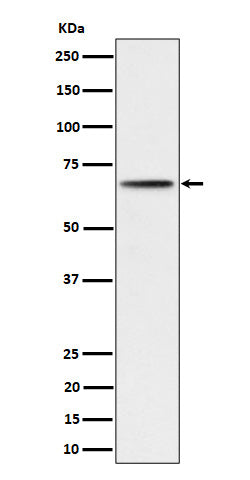 Anti-Phospho-P70 S6 Kinase beta (S371) Rabbit Monoclonal Antibody Boster Bio