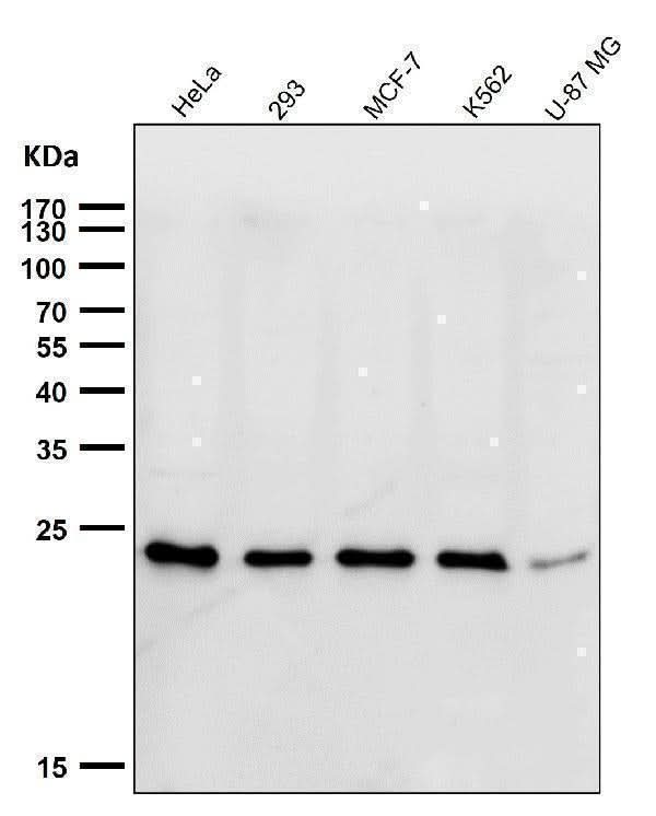 Anti-HSPC150 Rabbit Monoclonal Antibody Boster Bio