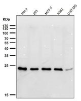 Anti-HSPC150 Rabbit Monoclonal Antibody Boster Bio