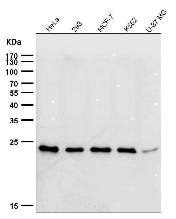 Anti-HSPC150 Rabbit Monoclonal Antibody Boster Bio