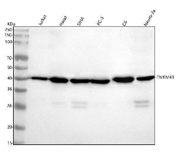 Anti-TMEM43 Rabbit Monoclonal Antibody Boster Bio