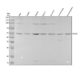 Anti-SEC62 Rabbit Monoclonal Antibody Boster Bio