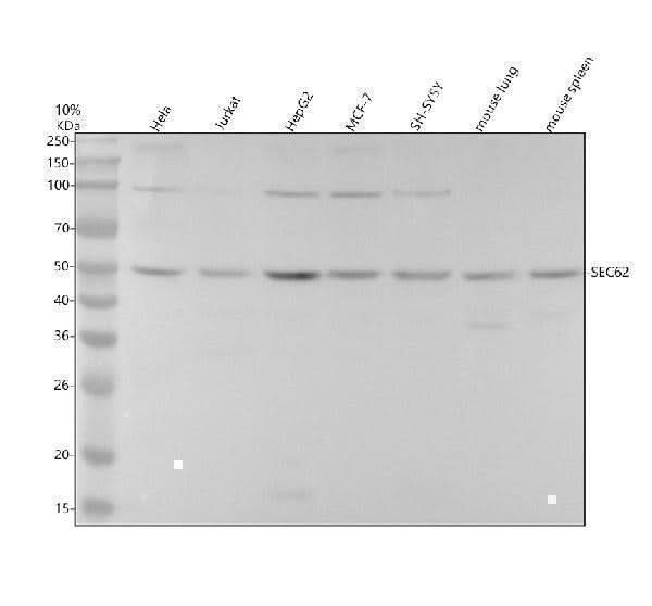 Anti-SEC62 Rabbit Monoclonal Antibody Boster Bio