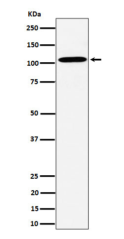 Anti-USO1 Rabbit Monoclonal Antibody Boster Bio