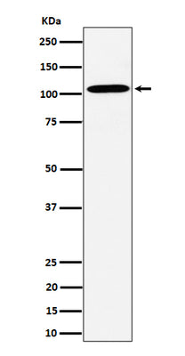 Anti-USO1 Rabbit Monoclonal Antibody Boster Bio