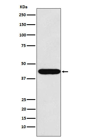 Anti-LHX2 Rabbit Monoclonal Antibody Boster Bio