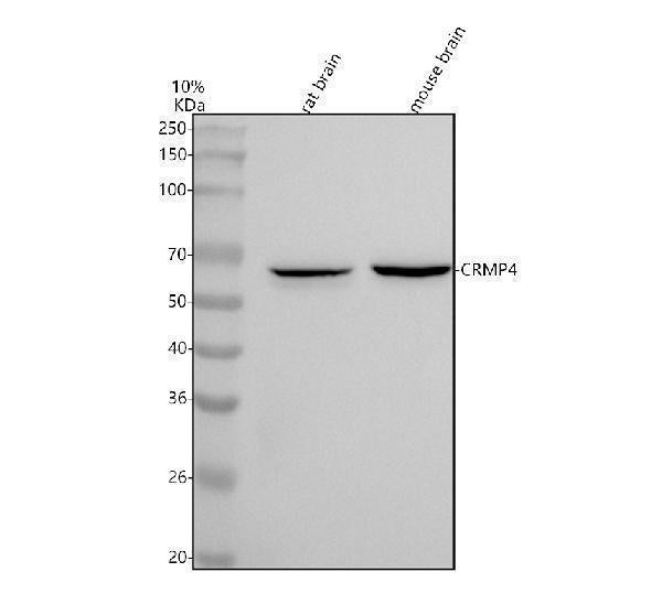 Anti-CRMP4 Rabbit Monoclonal Antibody Boster Bio