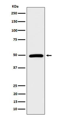 Anti-AMSH Rabbit Monoclonal Antibody Boster Bio