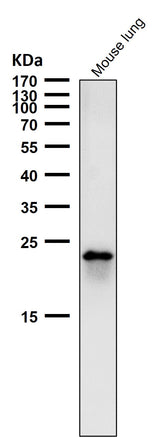 Anti-RAB22A Rabbit Monoclonal Antibody Boster Bio