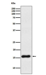 Anti-VAMP1 Rabbit Monoclonal Antibody Boster Bio