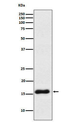 Anti-VAMP1 Rabbit Monoclonal Antibody Boster Bio