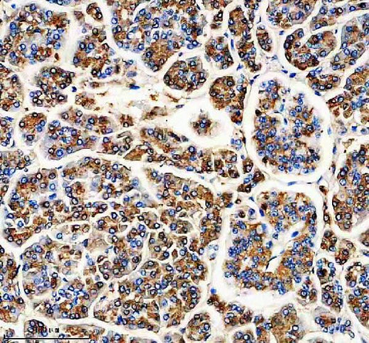 Anti-Carboxypeptidase A1+A2+B Rabbit Monoclonal Antibody Boster Bio