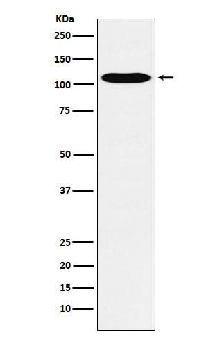 Anti-GPCR / LGR6 Rabbit Monoclonal Antibody Boster Bio
