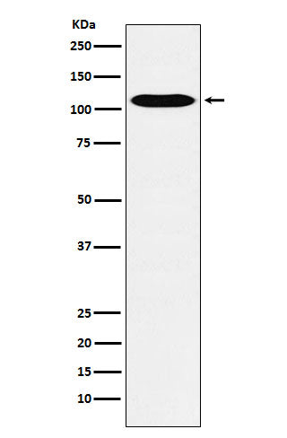 Anti-GPCR / LGR6 Rabbit Monoclonal Antibody Boster Bio