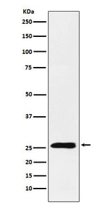 Anti-TNFSF9 Rabbit Monoclonal Antibody Boster Bio