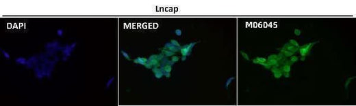 Anti-HoxC6 Rabbit Monoclonal Antibody Boster Bio
