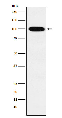 Anti-VPS18 Rabbit Monoclonal Antibody Boster Bio