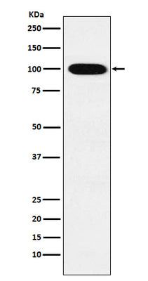 Anti-VPS18 Rabbit Monoclonal Antibody Boster Bio
