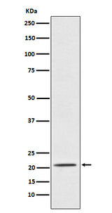 Anti-Placental Protein 14 / PAEP Rabbit Monoclonal Antibody Boster Bio