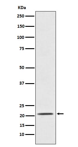 Anti-Placental Protein 14 / PAEP Rabbit Monoclonal Antibody Boster Bio