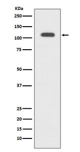 Anti-GART Rabbit Monoclonal Antibody Boster Bio