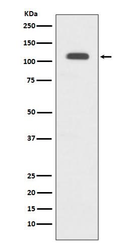 Anti-GART Rabbit Monoclonal Antibody Boster Bio