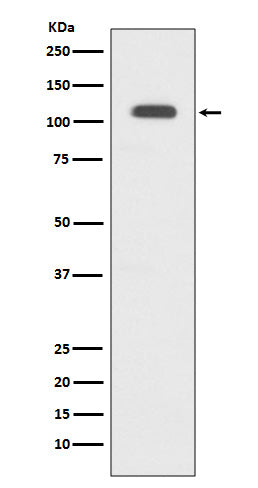 Anti-GART Rabbit Monoclonal Antibody Boster Bio