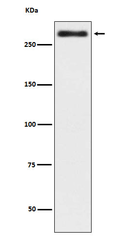 Anti-Talin 2 TLN2 Rabbit Monoclonal Antibody Boster Bio