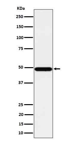 Anti-Tbp7 Rabbit Monoclonal Antibody Boster Bio