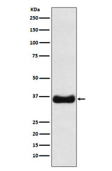 Anti-Olig1 Rabbit Monoclonal Antibody Boster Bio