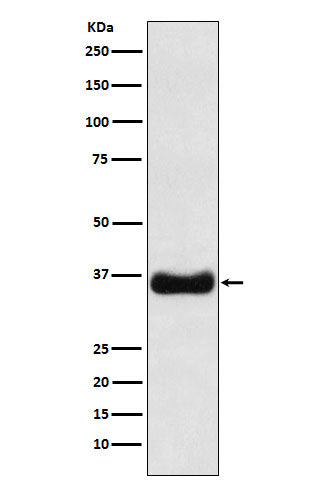 Anti-Olig1 Rabbit Monoclonal Antibody Boster Bio