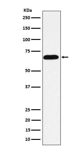 Anti-Alkaline phosphatase ALPI Rabbit Monoclonal Antibody Boster Bio